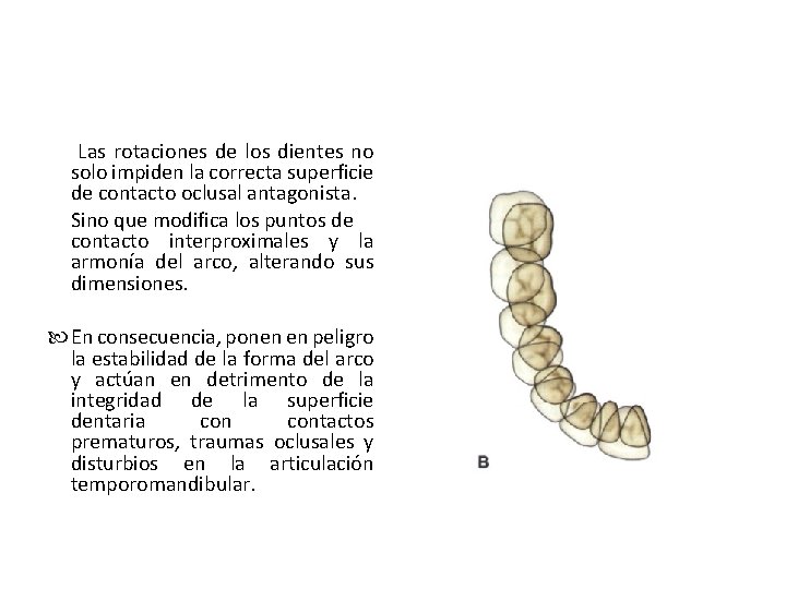 Las rotaciones de los dientes no solo impiden la correcta superficie de contacto oclusal