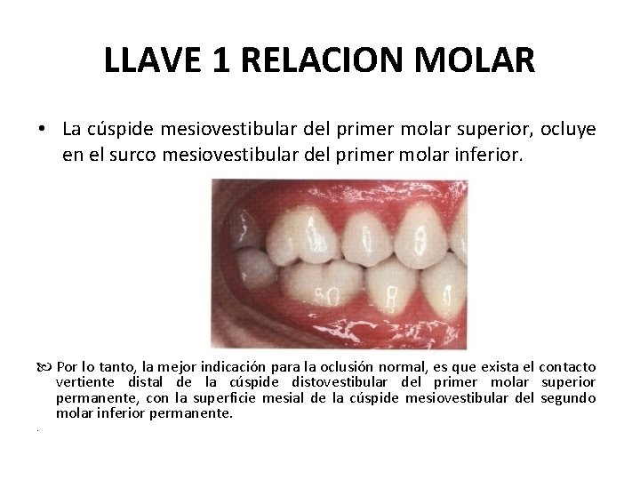 LLAVE 1 RELACION MOLAR • La cúspide mesiovestibular del primer molar superior, ocluye en