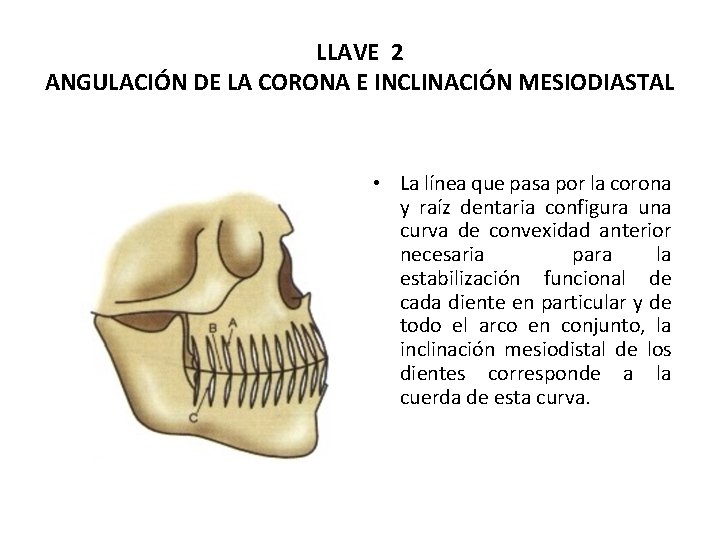 LLAVE 2 ANGULACIÓN DE LA CORONA E INCLINACIÓN MESIODIASTAL • La línea que pasa