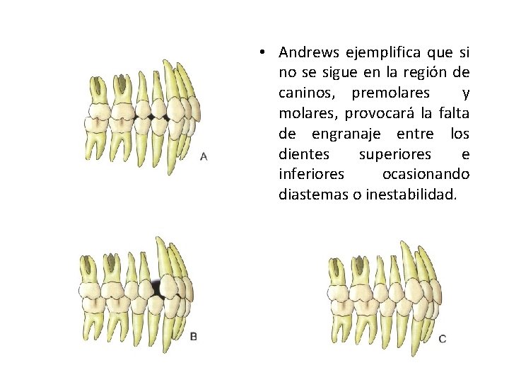  • Andrews ejemplifica que si no se sigue en la región de caninos,