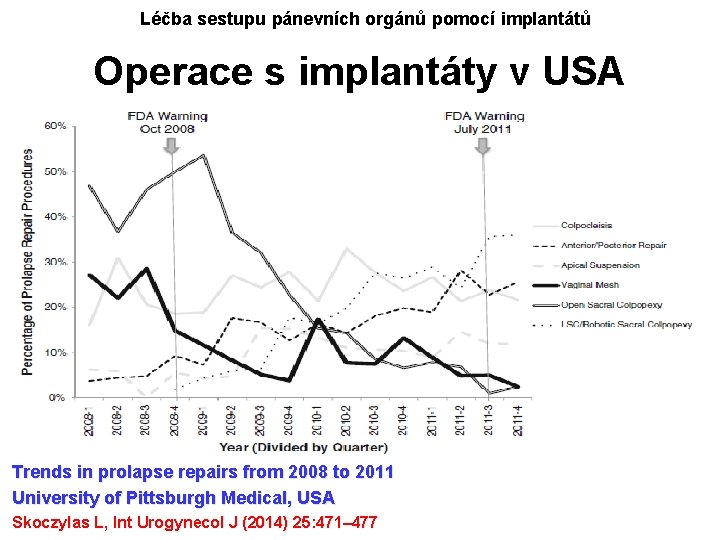 Léčba sestupu pánevních orgánů pomocí implantátů Operace s implantáty v USA Trends in prolapse