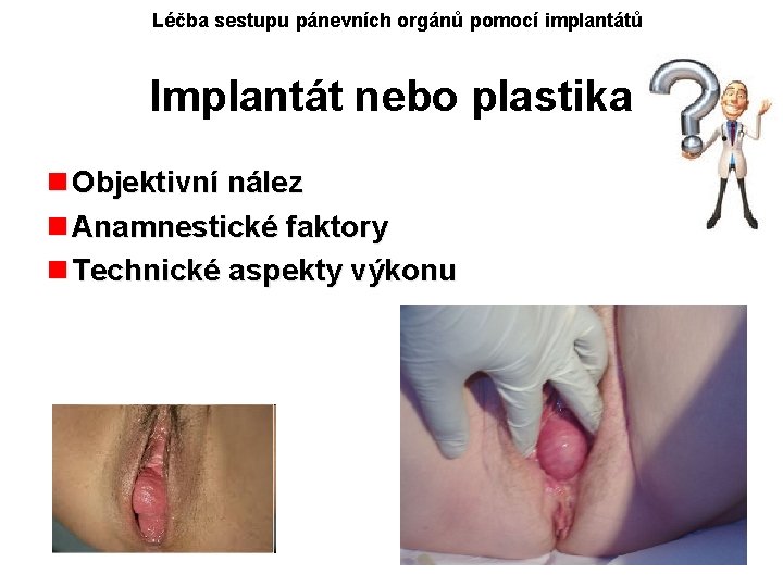 Léčba sestupu pánevních orgánů pomocí implantátů Implantát nebo plastika n Objektivní nález n Anamnestické