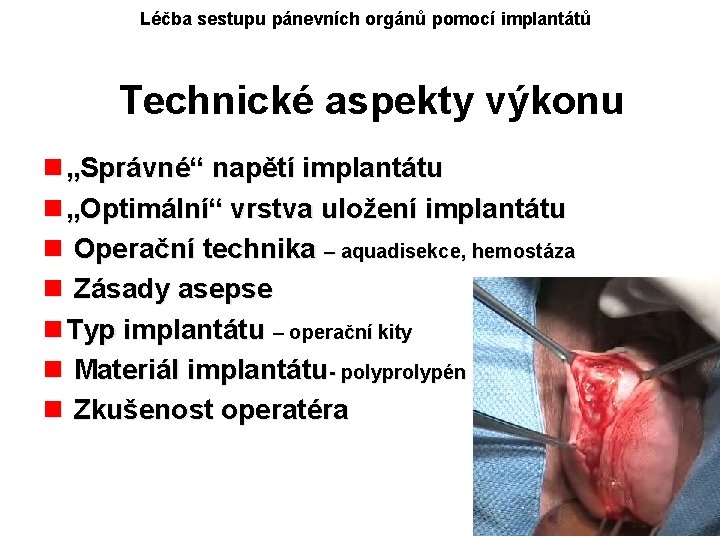 Léčba sestupu pánevních orgánů pomocí implantátů Technické aspekty výkonu n „Správné“ napětí implantátu n