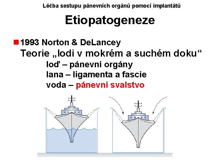 Léčba sestupu pánevních orgánů pomocí implantátů Etiopatogeneze n 1993 Norton & De. Lancey Teorie