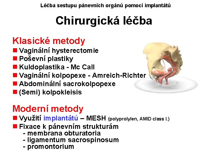 Léčba sestupu pánevních orgánů pomocí implantátů Chirurgická léčba Klasické metody n Vaginální hysterectomie n