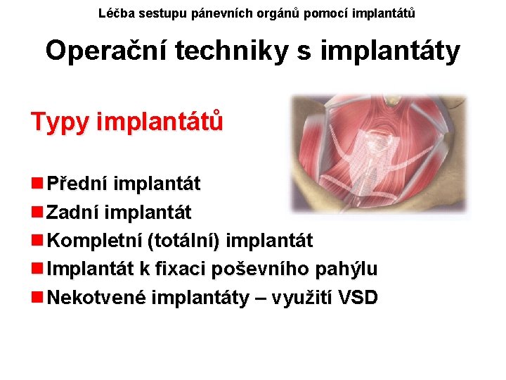 Léčba sestupu pánevních orgánů pomocí implantátů Operační techniky s implantáty Typy implantátů n Přední