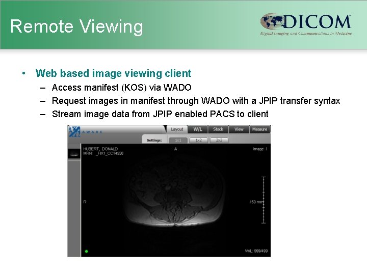 Remote Viewing • Web based image viewing client – Access manifest (KOS) via WADO