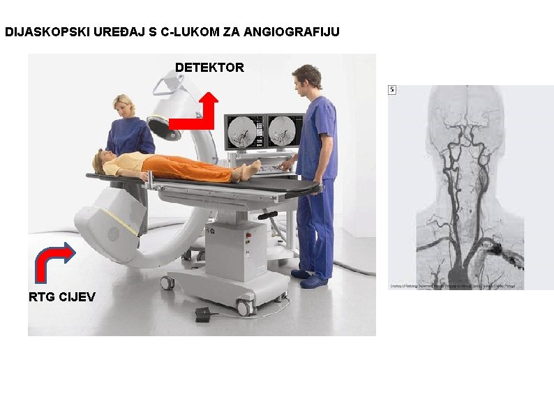 DIJASKOPSKI UREĐAJ S C-LUKOM ZA ANGIOGRAFIJU DETEKTOR RTG CIJEV 