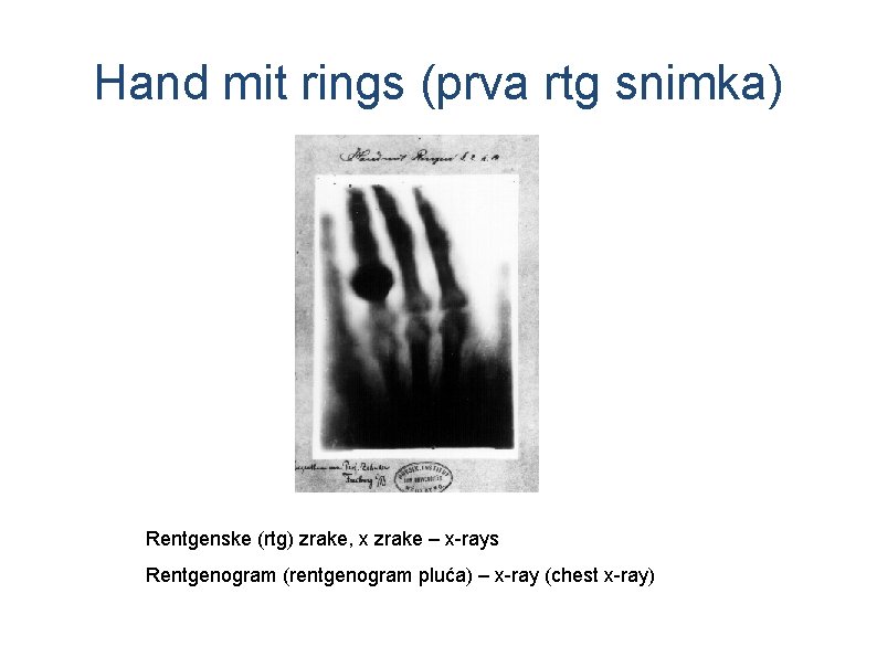 Hand mit rings (prva rtg snimka) Rentgenske (rtg) zrake, x zrake – x-rays Rentgenogram