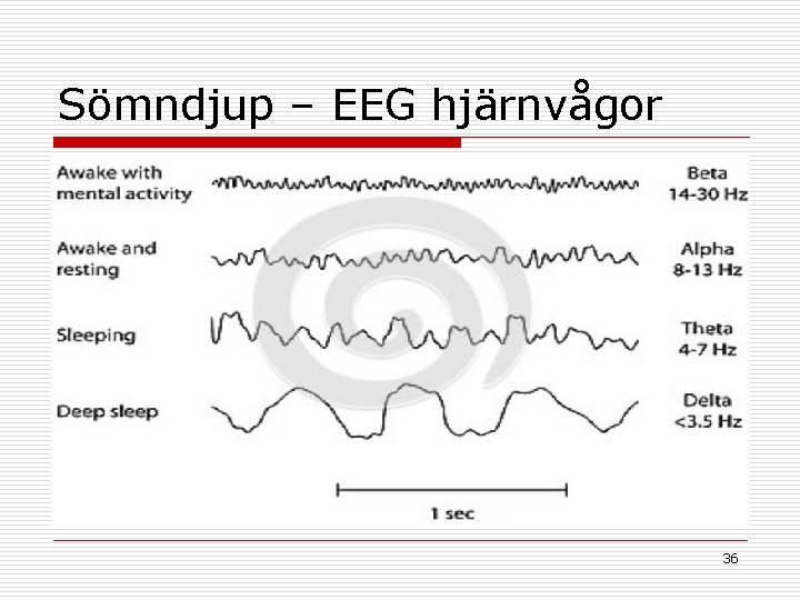 Sömndjup – EEG hjärnvågor 36 