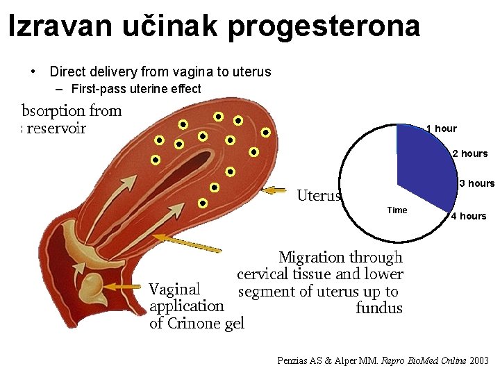 Izravan učinak progesterona • Direct delivery from vagina to uterus – First-pass uterine effect