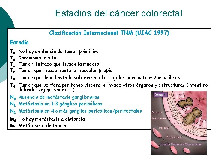 Estadios del cáncer colorectal Clasificación Internacional TNM (UIAC 1997) Estadío T 0 Tis T