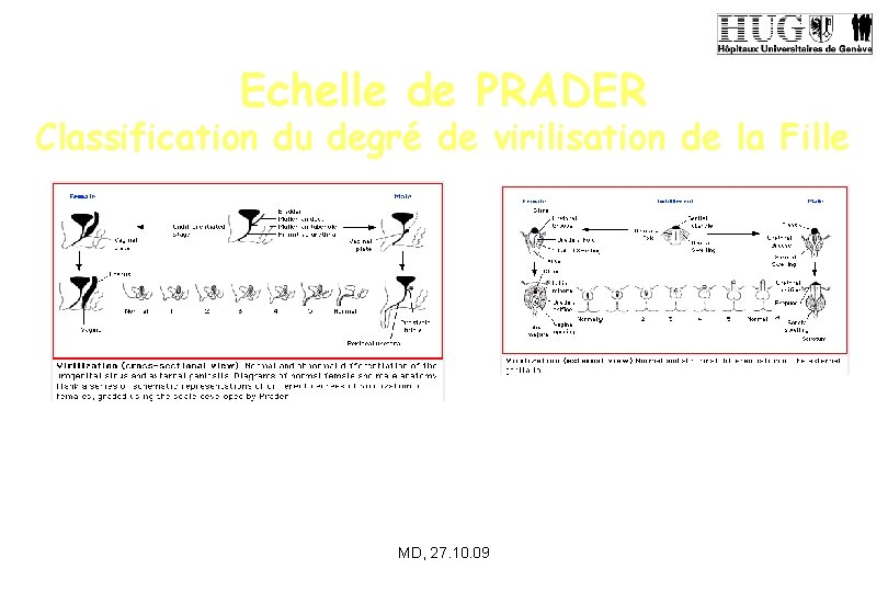 Echelle de PRADER Classification du degré de virilisation de la Fille MD, 27. 10.