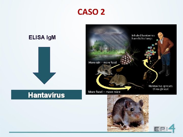 CASO 2 ELISA Ig. M Hantavírus 