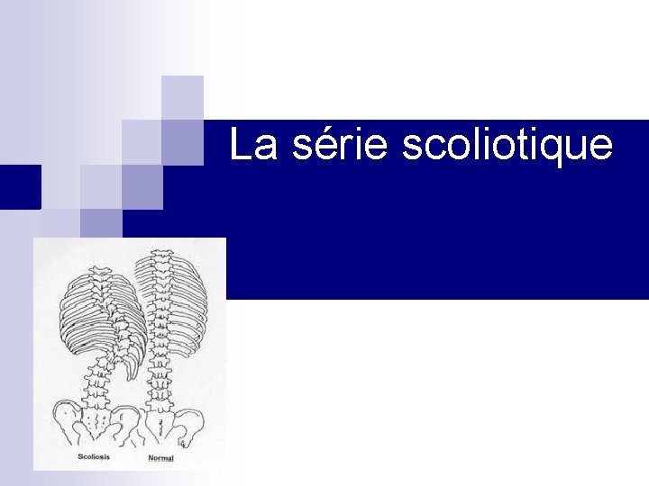 La série scoliotique 