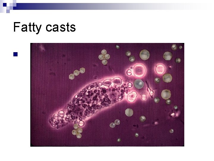 Fatty casts n 