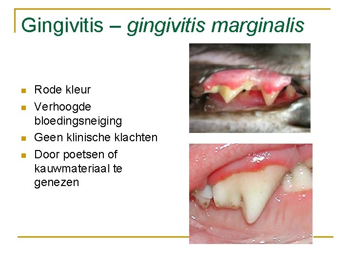 Gingivitis – gingivitis marginalis n n Rode kleur Verhoogde bloedingsneiging Geen klinische klachten Door