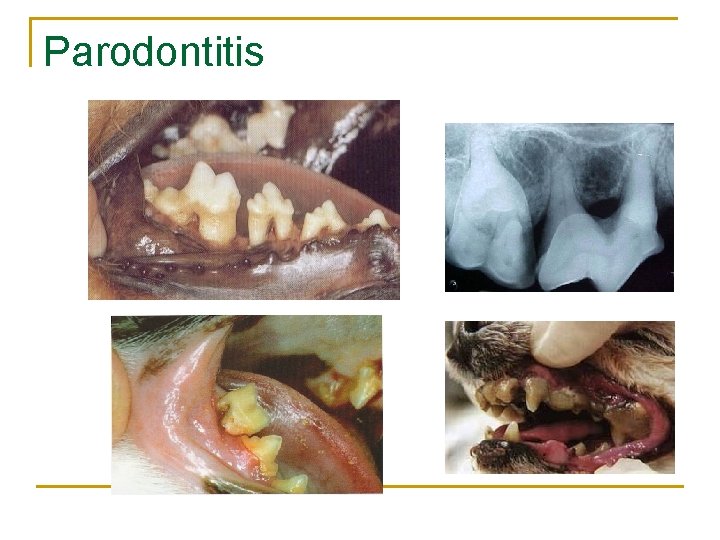 Parodontitis 