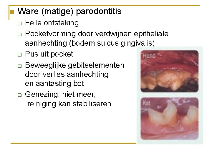 n Ware (matige) parodontitis q q q Felle ontsteking Pocketvorming door verdwijnen epitheliale aanhechting