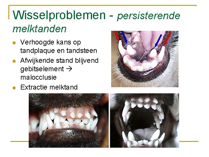 Wisselproblemen - persisterende melktanden n Verhoogde kans op tandplaque en tandsteen Afwijkende stand blijvend