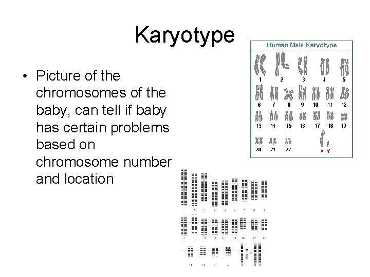 Karyotype • Picture of the chromosomes of the baby, can tell if baby has