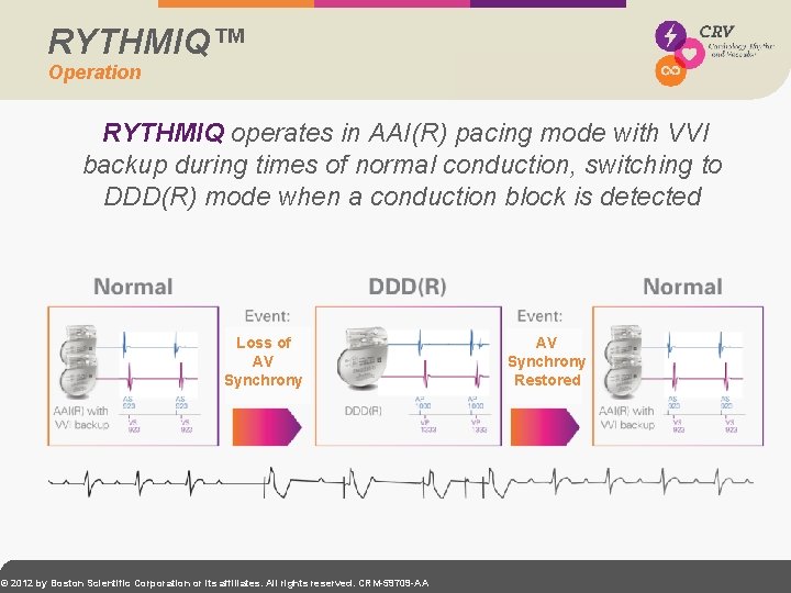 RYTHMIQ™ Operation RYTHMIQ operates in AAI(R) pacing mode with VVI backup during times of