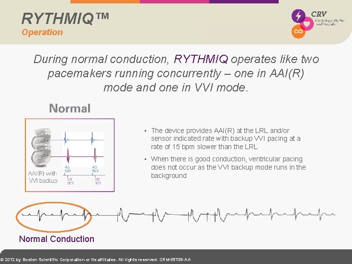 RYTHMIQ™ Operation During normal conduction, RYTHMIQ operates like two pacemakers running concurrently – one