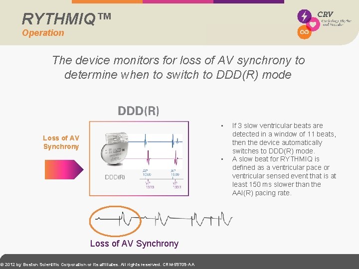 RYTHMIQ™ Operation The device monitors for loss of AV synchrony to determine when to