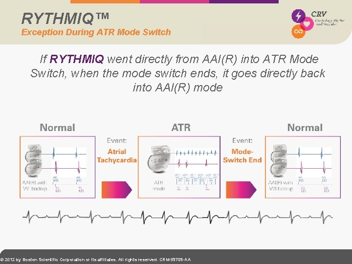 RYTHMIQ™ Exception During ATR Mode Switch If RYTHMIQ went directly from AAI(R) into ATR