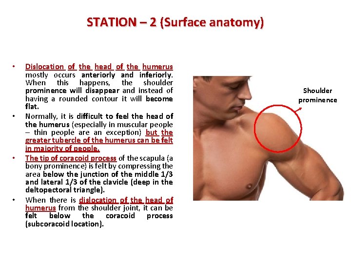 STATION – 2 (Surface anatomy) • • Dislocation of the head of the humerus