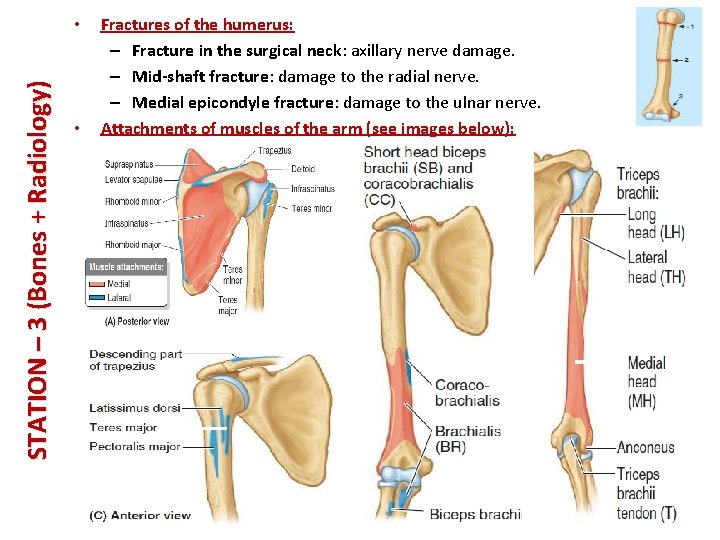 STATION – 3 (Bones + Radiology) • • Fractures of the humerus: – Fracture