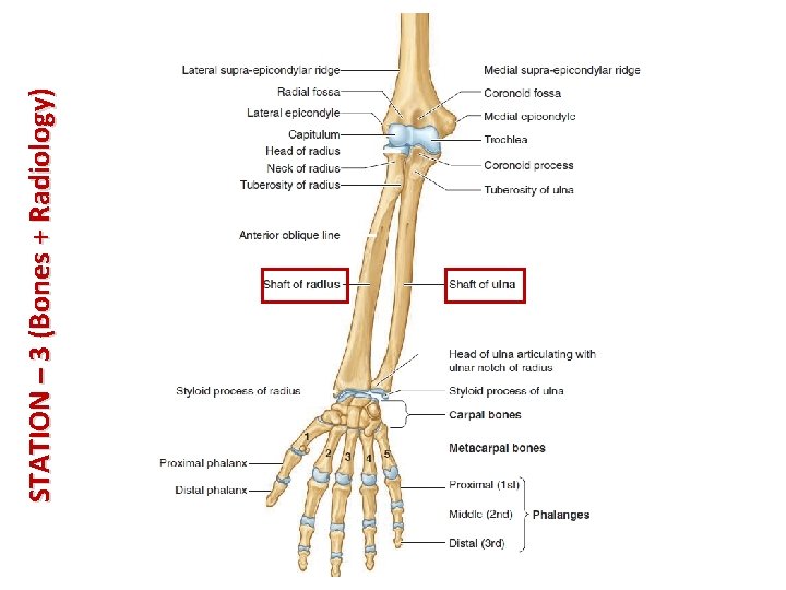 STATION – 3 (Bones + Radiology) 