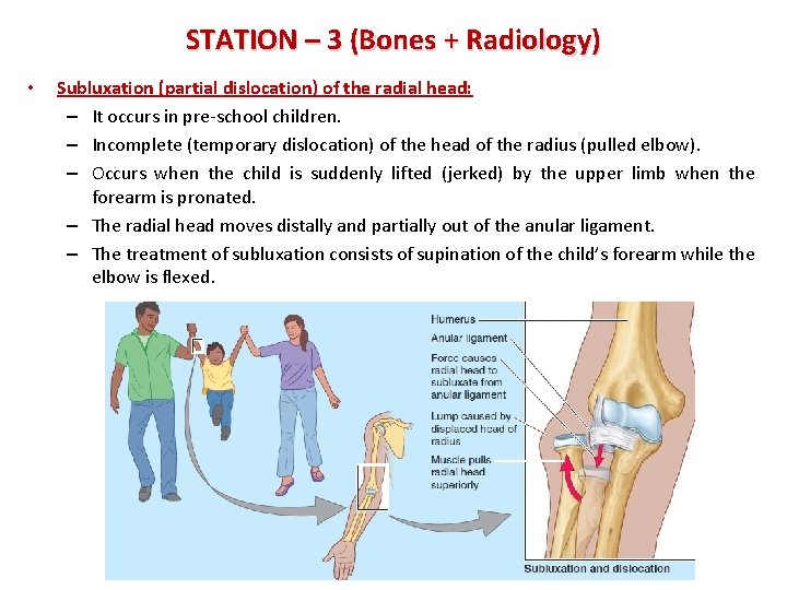 STATION – 3 (Bones + Radiology) • Subluxation (partial dislocation) of the radial head: