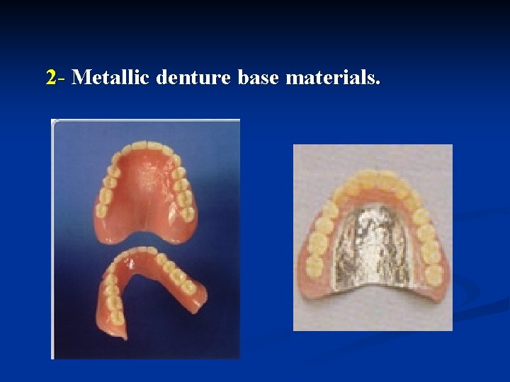 2 - Metallic denture base materials. 