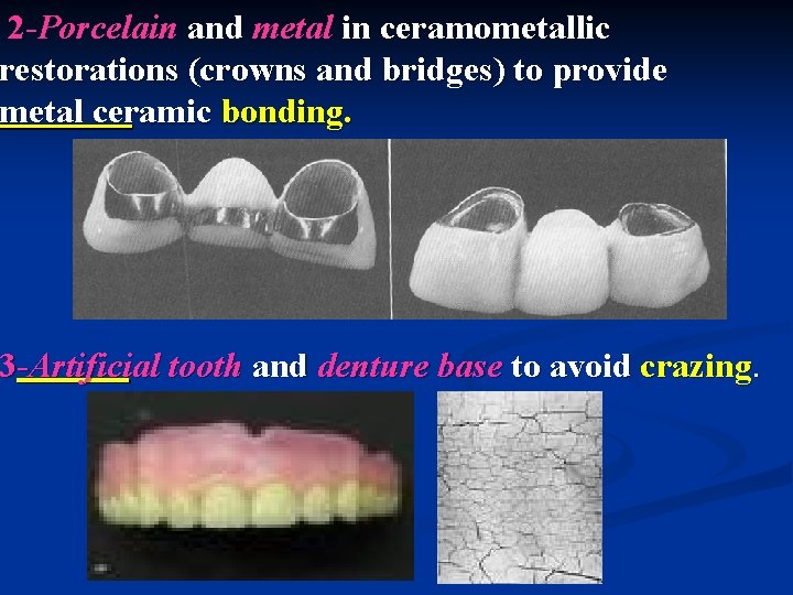 2 -Porcelain and metal in ceramometallic restorations (crowns and bridges) to provide metal ceramic