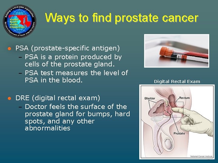 Ways to find prostate cancer l l PSA (prostate-specific antigen) – PSA is a