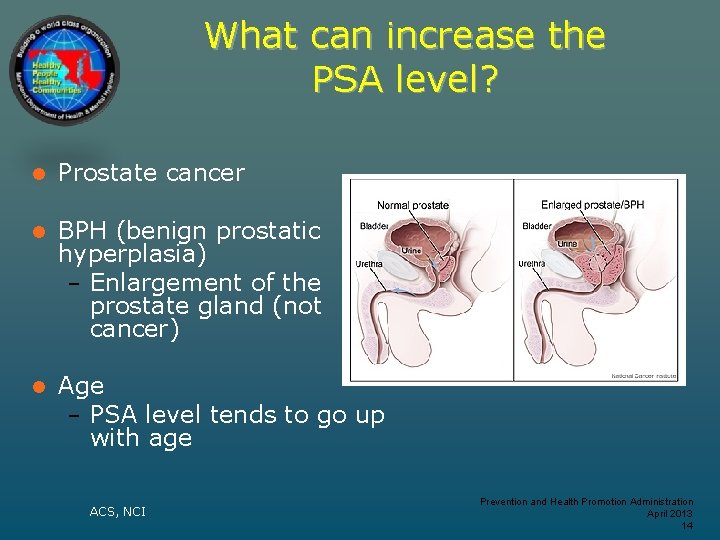 What can increase the PSA level? l Prostate cancer l BPH (benign prostatic hyperplasia)