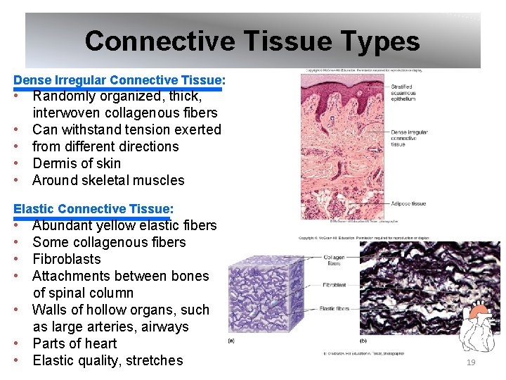 Connective Tissue Types Dense Irregular Connective Tissue: • Randomly organized, thick, interwoven collagenous fibers