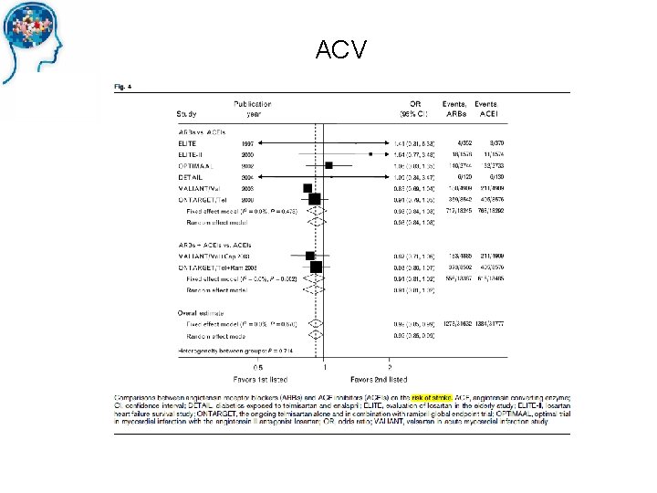 ACV 