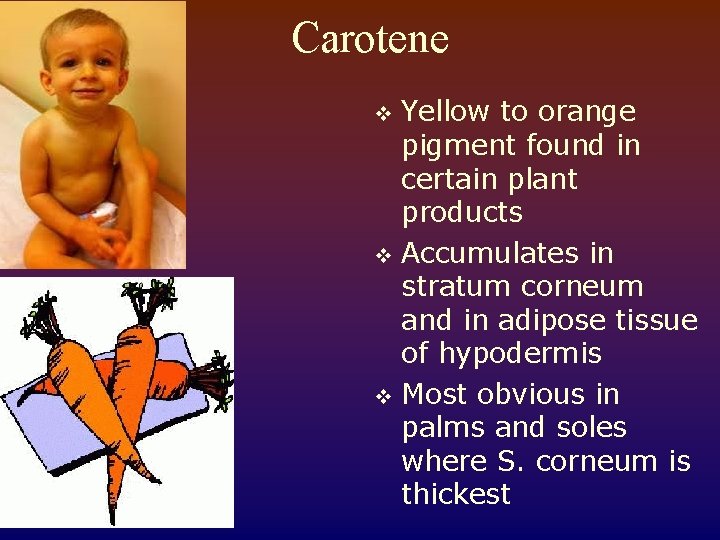 Carotene Yellow to orange pigment found in certain plant products v Accumulates in stratum