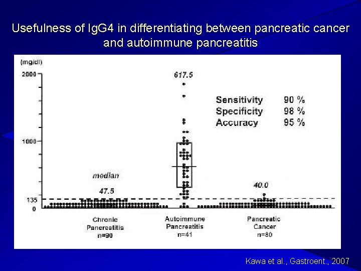 Usefulness of Ig. G 4 in differentiating between pancreatic cancer and autoimmune pancreatitis Kawa