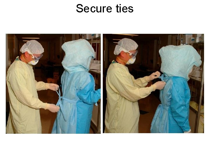 Secure ties 