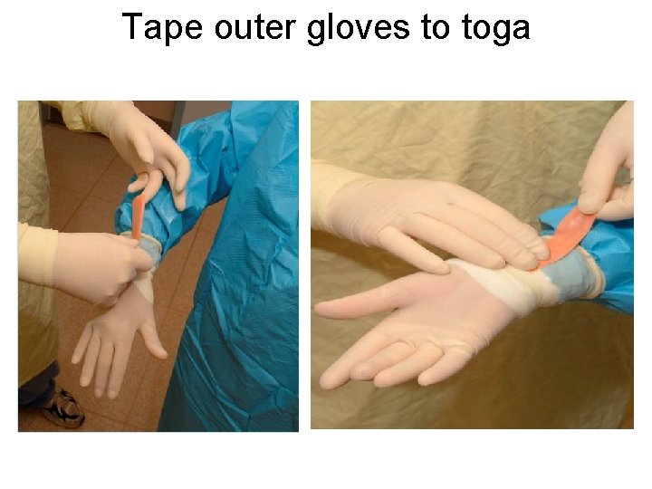 Tape outer gloves to toga 