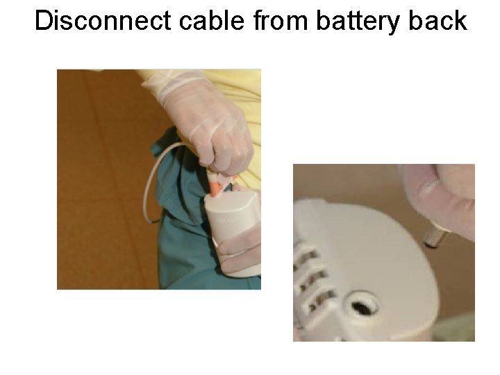 Disconnect cable from battery back 