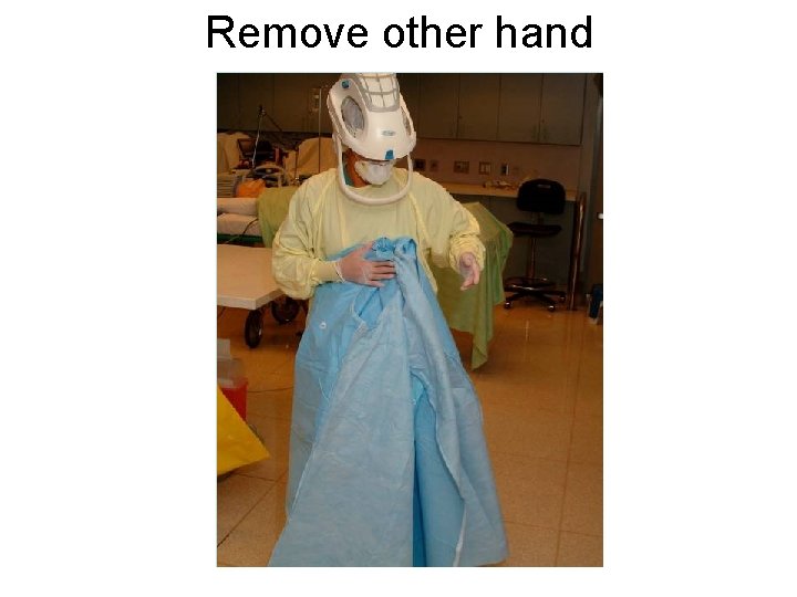 Remove other hand 