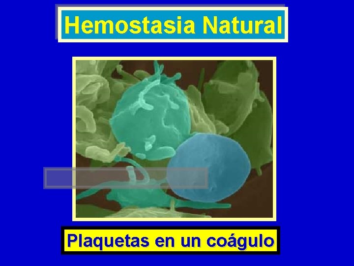 Hemostasia Natural Plaquetas en un coágulo Hemostasia Natural Plaquetas en un coágulo