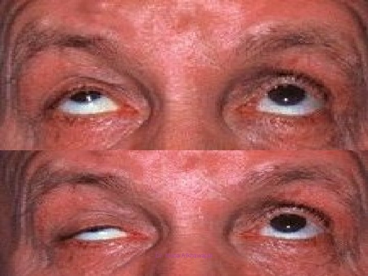 Fatigability test Dr. Nuha Alkhawajah 