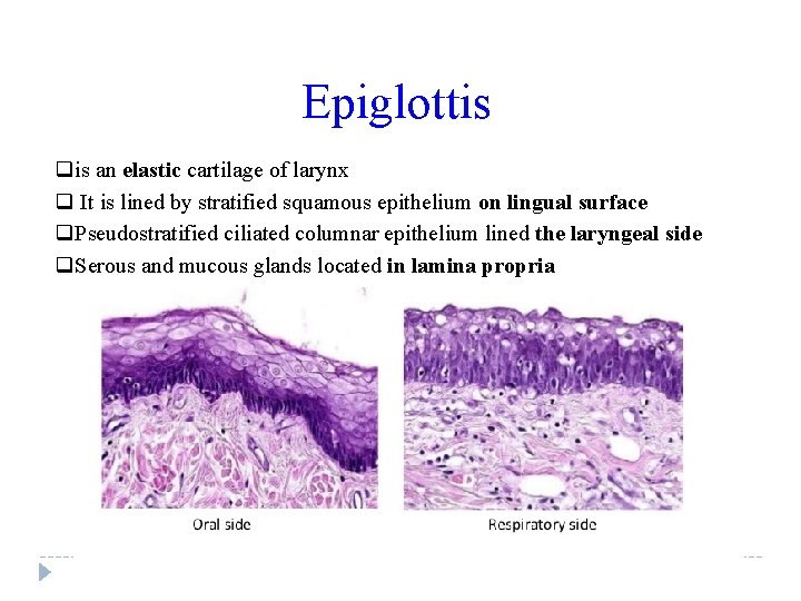 Epiglottis qis an elastic cartilage of larynx q It is lined by stratified squamous