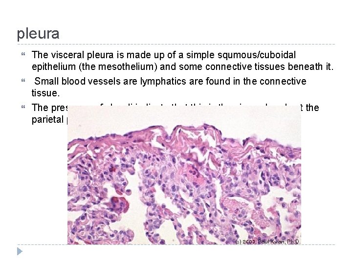 pleura The visceral pleura is made up of a simple squmous/cuboidal epithelium (the mesothelium)