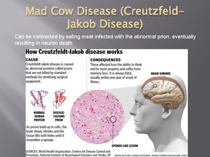 Mad Cow Disease (Creutzfeld. Jakob Disease) Can be contracted by eating meat infected with Mad Cow Disease (Creutzfeld. Jakob Disease) Can be contracted by eating meat infected with